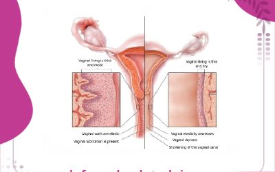 سریعترین درمان خشکی واژن چیست؟