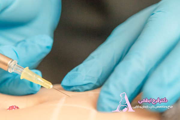 مزیت کربوکسی تراپی نسبت به دیگر روشهای جوانسازی واژن چیست؟