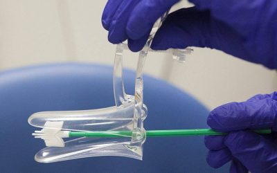 تست پاپ اسمیر چیست؟