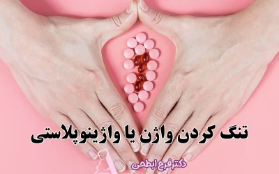 عمل تنگ کردن واژن؛ بهترین روش واژینوپلاستی