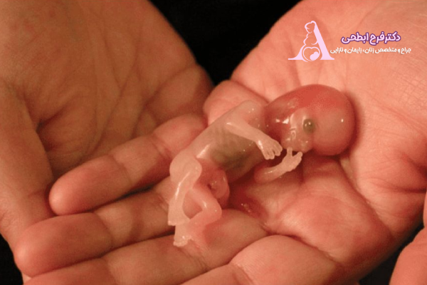 سقط جنین چیست؟