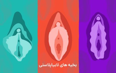 مراقبت از بخیههای لابیاپلاستی چگونه است؟