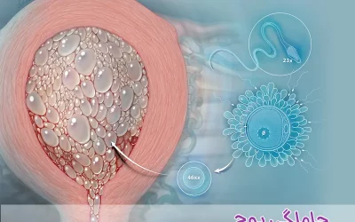 حاملگی پوچ یا مولار چیست و چه علائمی دارد؟