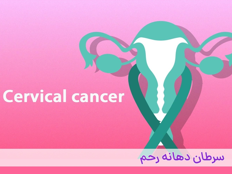 سرطان دهانه رحم