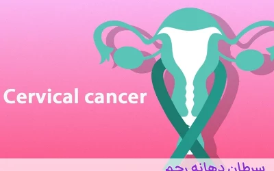 علائم ابتلا به سرطان دهانه رحم