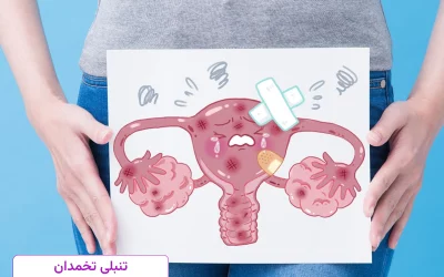 درمان تنبلی تخمدان در ساری