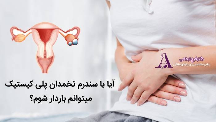 بارداری با سندرم تخمدان پلی کیستیک