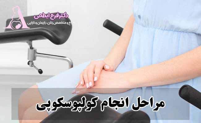 مراحل انجام کولپوسکوپی