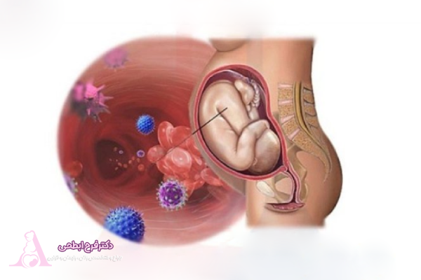 تاثیر اچ پی وی بر سلامت روان در بارداری