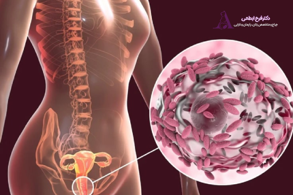 علائم عفونت مکرر واژن