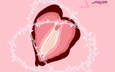 واژینیسموس چیست؟