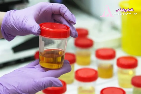 آزمایش ادرار