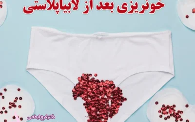 خونریزی بعد از لابیاپلاستی