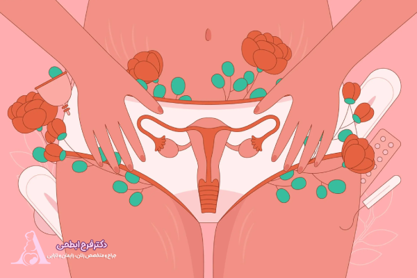 علت خونریزی بعد از لابیاپلاستی