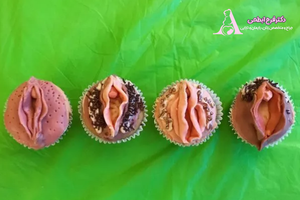 محل انجام جراحی لابیاپلاستی