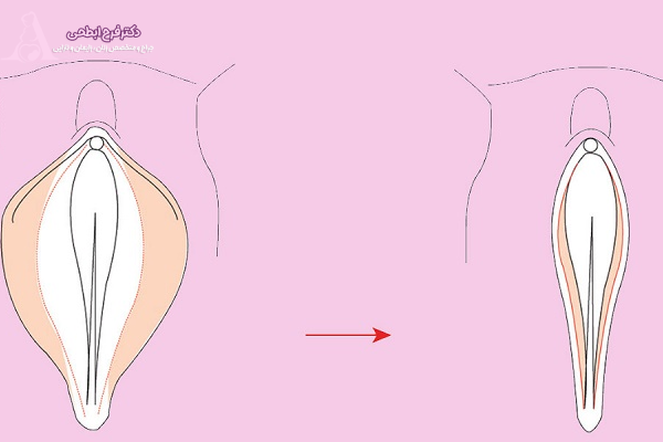 نکات مهم قبل از تصمیمگیری بر اساس هزینه