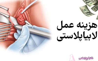 هزینه عمل لابیاپلاستی در ساری