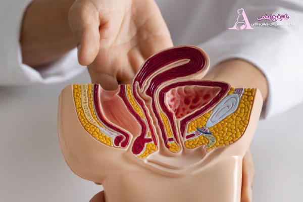 هزینه عمل پرینورافی در سال ۱۴۰۴ چقدر است؟