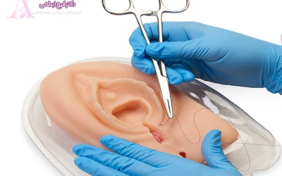 هزینه عمل پرینورافی چقدر است؟